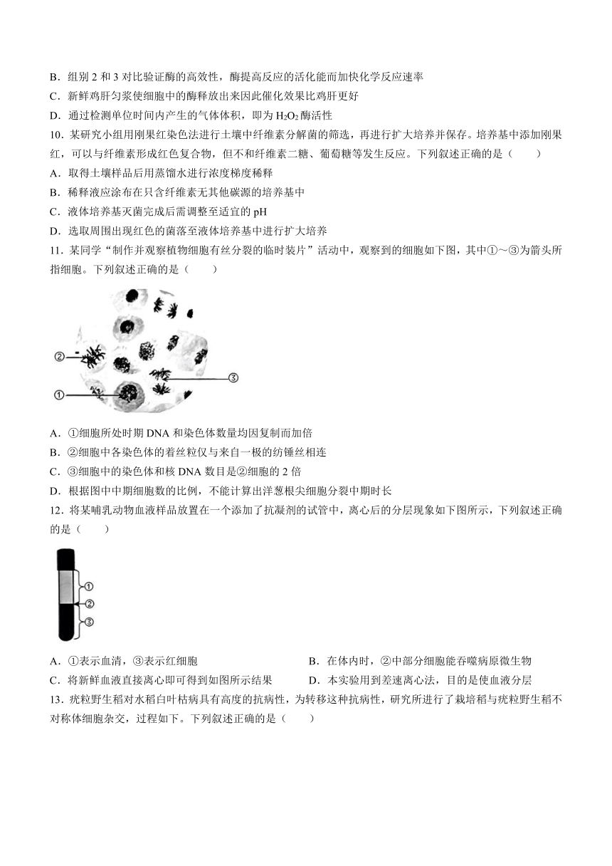 浙江省绍兴市2023-2024学年高二下学期6月期末生物试题(无答案)